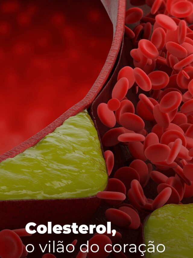 Colesterol
